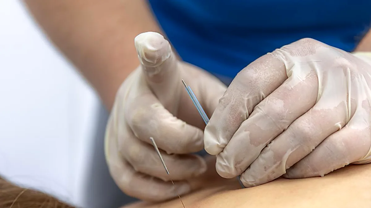 Acupuntura dói?