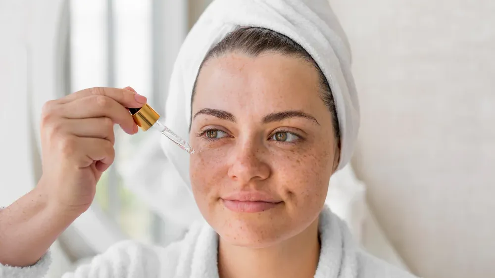 Melasma pode piorar com procedimento estético? O que saber antes
