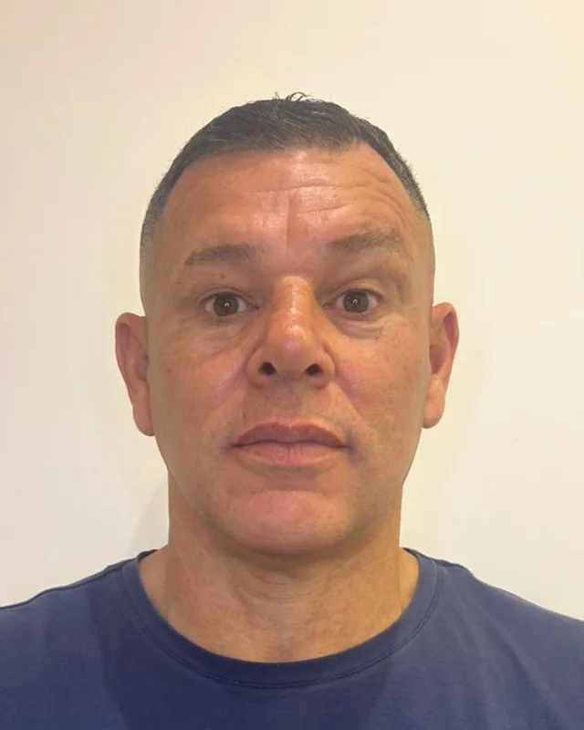Homem de meia-idade fotografado de frente, antes e depois da aplicação de toxina botulínica na testa — depois