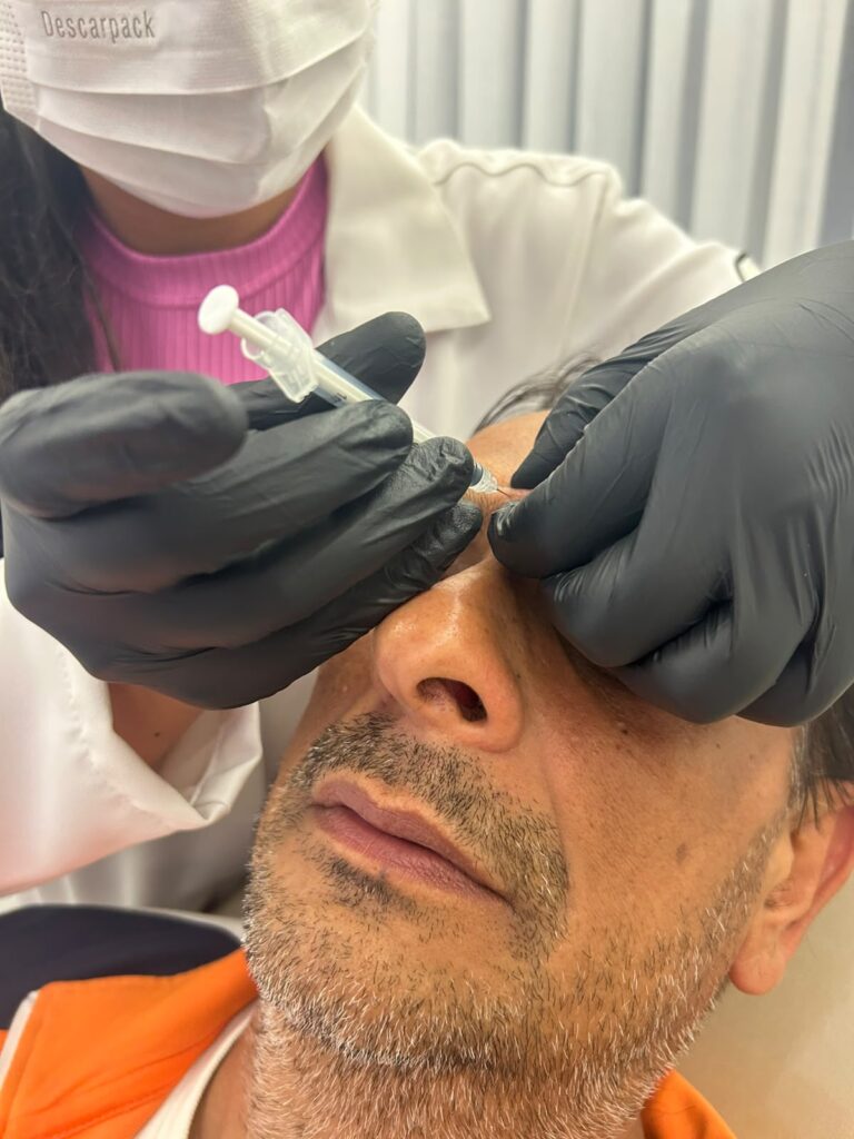 Botox preventivo funciona? Quando começar a prevenir rugas?